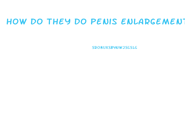 How Do They Do Penis Enlargements