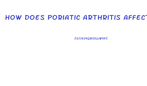 How Does Poriatic Arthritis Affect Sex Drive