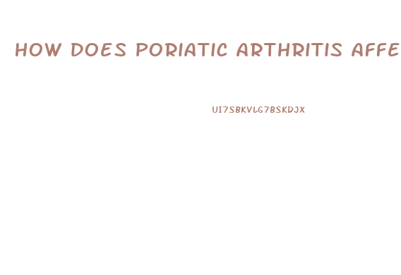 How Does Poriatic Arthritis Affect Sex Drive