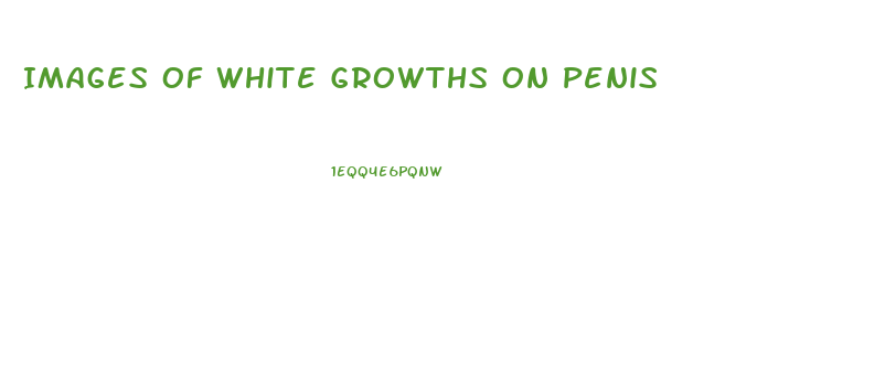Images Of White Growths On Penis
