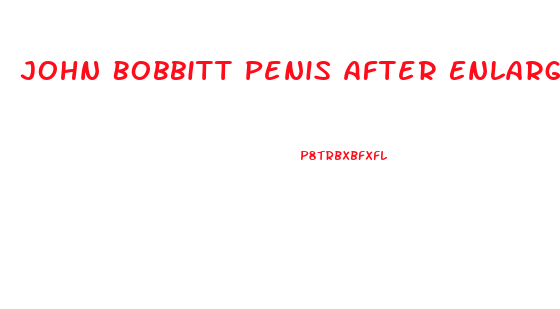 John Bobbitt Penis After Enlargement