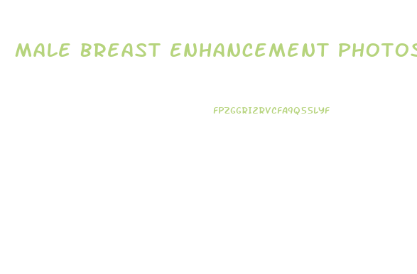 Male Breast Enhancement Photos
