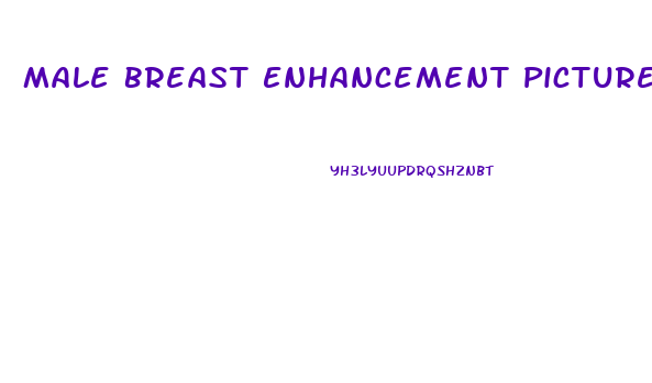 Male Breast Enhancement Pictures