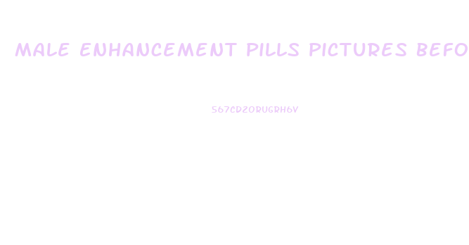 Male Enhancement Pills Pictures Before And After