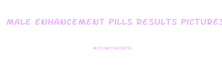 Male Enhancement Pills Results Pictures