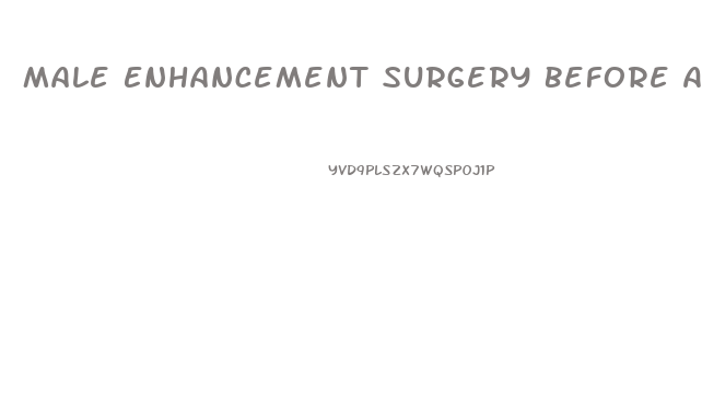 Male Enhancement Surgery Before After Pictures