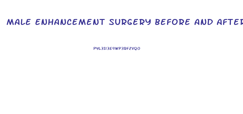 Male Enhancement Surgery Before And After Photos