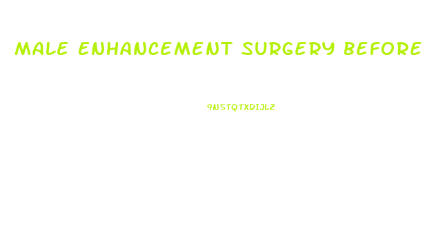 Male Enhancement Surgery Before And After Pictures