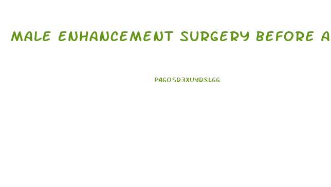 Male Enhancement Surgery Before And After Pictures