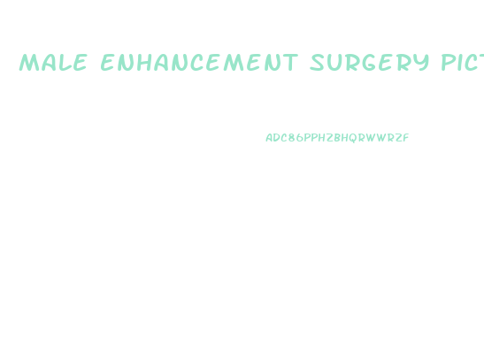 Male Enhancement Surgery Pictures