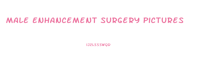 Male Enhancement Surgery Pictures