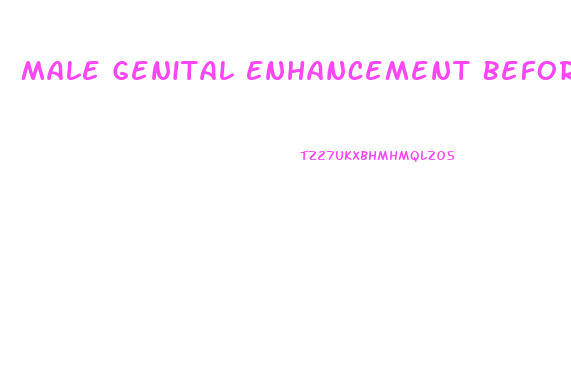 Male Genital Enhancement Before And After Pictures