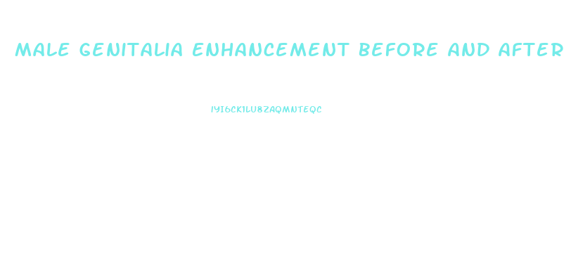Male Genitalia Enhancement Before And After