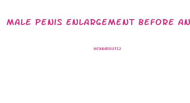 Male Penis Enlargement Before And After