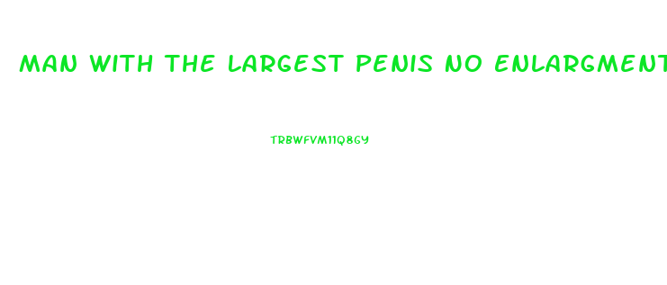 Man With The Largest Penis No Enlargment