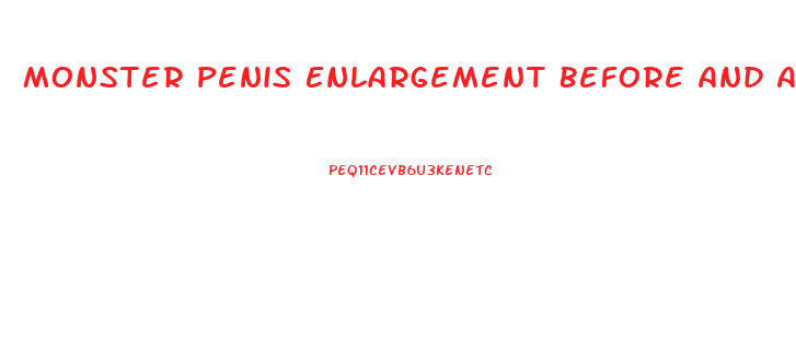 Monster Penis Enlargement Before And After