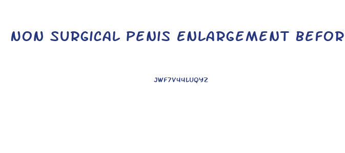 Non Surgical Penis Enlargement Before And After