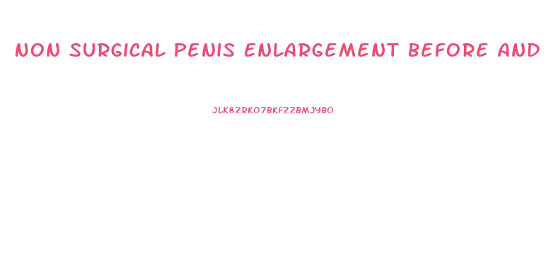 Non Surgical Penis Enlargement Before And After