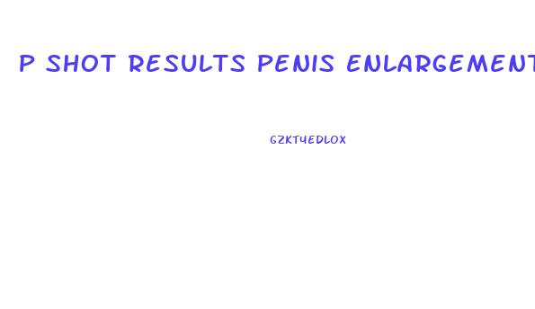 P Shot Results Penis Enlargement