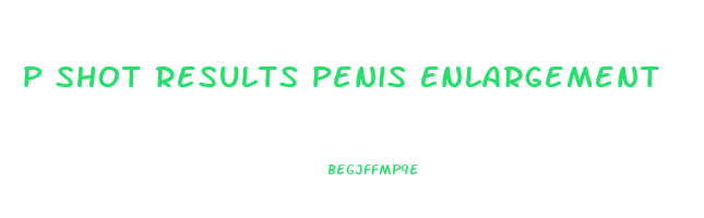 P Shot Results Penis Enlargement