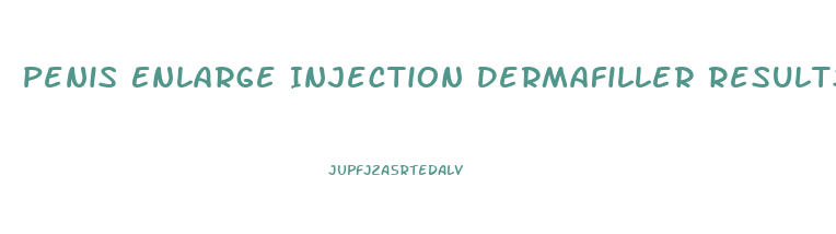 Penis Enlarge Injection Dermafiller Results Erect