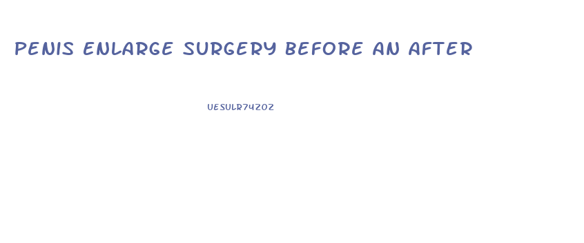 Penis Enlarge Surgery Before An After