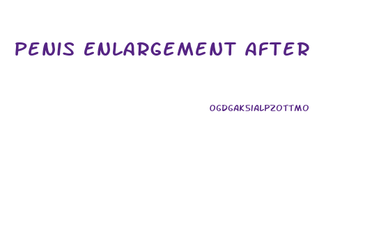 Penis Enlargement After