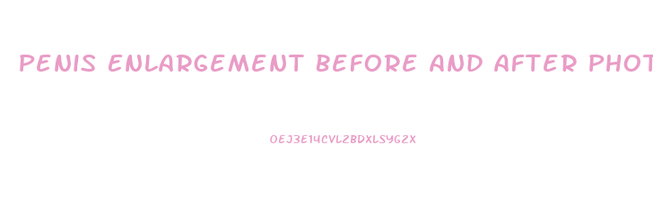 Penis Enlargement Before And After Phots
