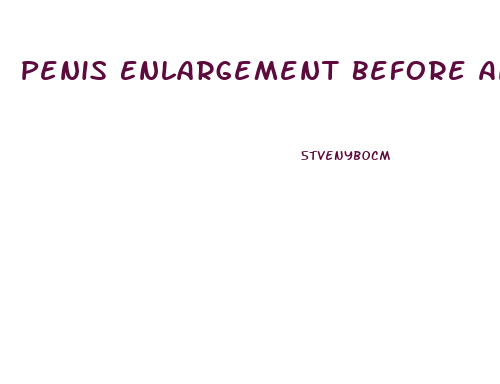 Penis Enlargement Before And After Pic