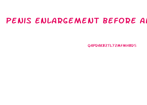 Penis Enlargement Before And After Results