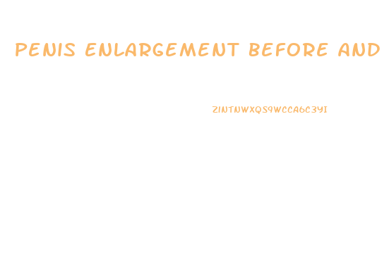 Penis Enlargement Before And After