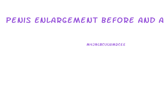 Penis Enlargement Before And After