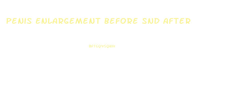 Penis Enlargement Before Snd After