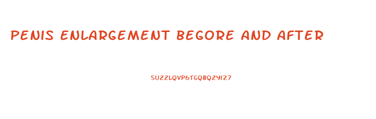 Penis Enlargement Begore And After