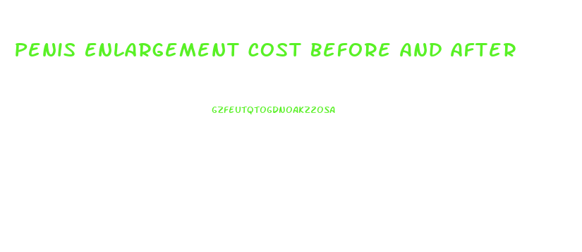 Penis Enlargement Cost Before And After