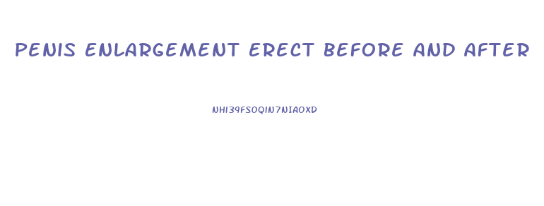 Penis Enlargement Erect Before And After