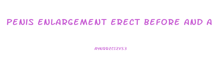 Penis Enlargement Erect Before And After Surgery