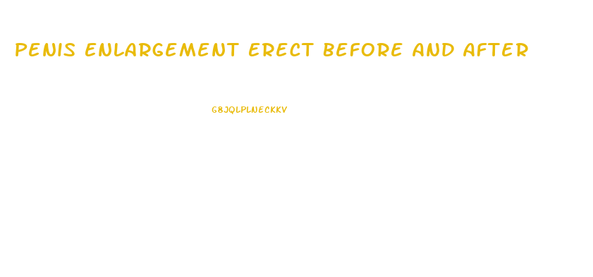 Penis Enlargement Erect Before And After