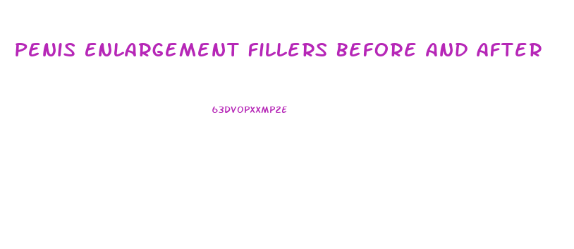 Penis Enlargement Fillers Before And After