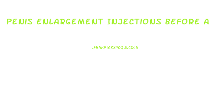Penis Enlargement Injections Before And After