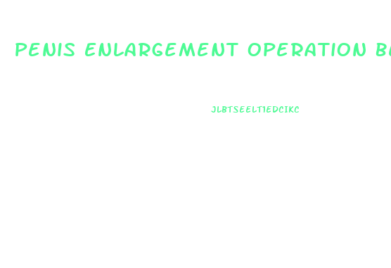 Penis Enlargement Operation Before After