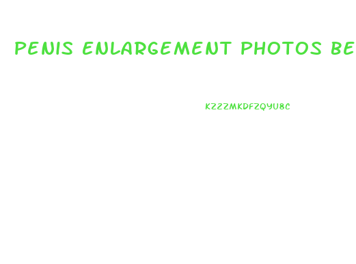Penis Enlargement Photos Before And After
