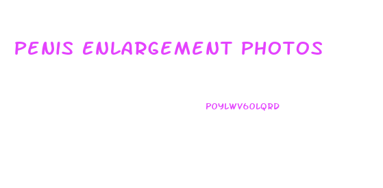 Penis Enlargement Photos