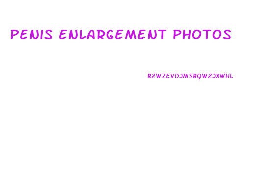 Penis Enlargement Photos