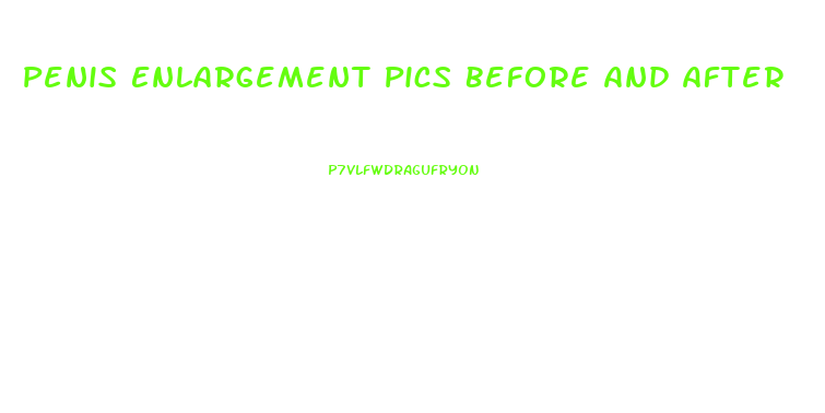 Penis Enlargement Pics Before And After