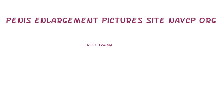Penis Enlargement Pictures Site Navcp Org