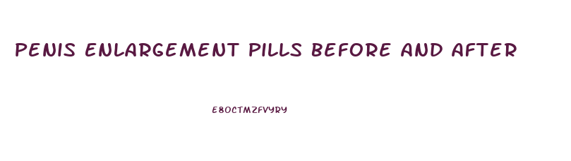 Penis Enlargement Pills Before And After