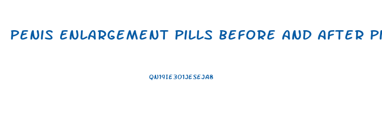 Penis Enlargement Pills Before And After Pics