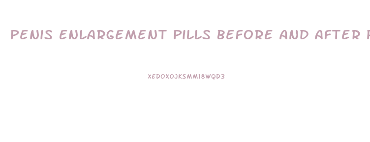 Penis Enlargement Pills Before And After Pics