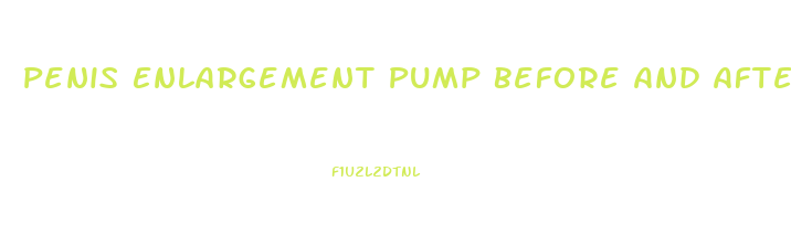 Penis Enlargement Pump Before And After